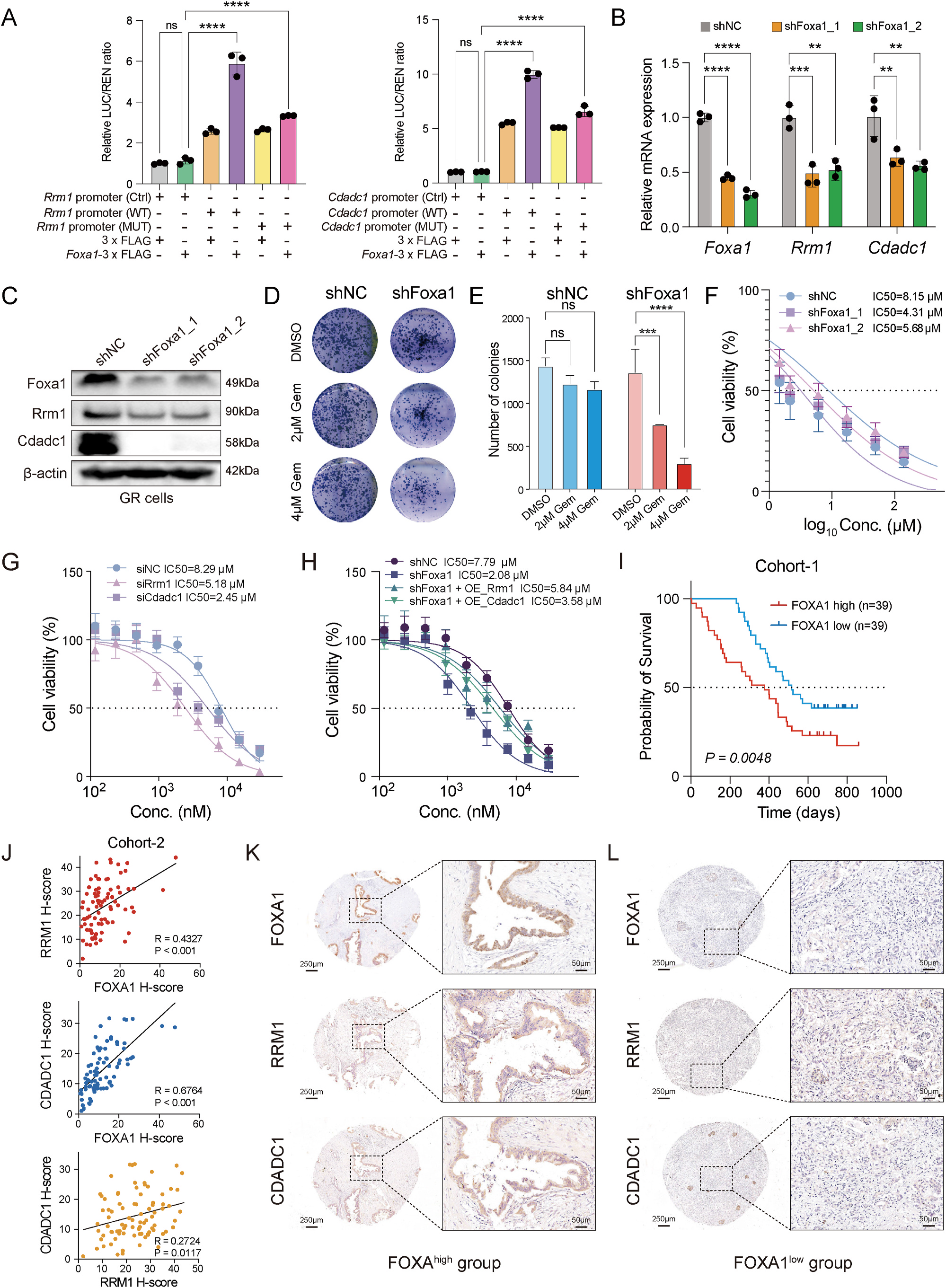 Fig. 5：Suppression of Foxa1 led to reduced cell viability and increased sensitivity to gemcitabine via downregulation of Rrm1 and Cdadc1. (A) Dual luciferase assay showing Rrm1 (left panel) and Cdadc1 (right panel) promoter activity expressed as a ratio of luciferase (LUC) to Renilla (REN), where an increase in activity equates to an increase in LUC relative to REN. Asterisks indicate significant differences determined by Student&rsquo;s t-test at P < 0.0001. (B and C) qPCR (B) and western blots (C) showing the mRNA and protein levels of Rrm1 and Cdadc1 in GR cells following Foxa1 knockdown via shRNA transfection. (D and E) Representative images (D) and quantification (E) of colony formation in GR cells. (F) The impact of Foxa1 knockdown on gemcitabine sensitivity in GR cells was measured via the sulfo\u00ad rhodamine B (SRB) assay. (G) Dose-response curves of GR cell viability (%) treated with increasing concentrations of gemcitabine following transfection with negative control siRNA (siNC) or siRNAs targeting Rrm1 (siRrm1) or Cdadc1 (siCdadc1). IC50 values indicate increased chemosensitivity upon Rrm1 or Cdadc1 knockdown. (H) Rescue experiments in Foxa1-depleted (shFoxa1) GR cells overexpressing Rrm1 (OE Rrm1) or Cdadc1 (OE Cdadc1). Dose-response curves demonstrate partial restoration of gemcitabine resistance, with IC50 values highlighting the roles of Rrm1 and Cdadc1 in Foxa1-mediated drug response. (I) Kaplan- Meier analysis of overall survival in a pancreatic cancer cohort (Ruijin hospital, China) stratified by FOXA1 expression (high vs. low, n = 39 each). High FOXA1 correlates with poorer prognosis (log-rank test, P = 0.0048). (J) Scatter plots showing significant positive correlations among FOXA1, RRM1, and CDADC1 protein levels (H-scores) in human PDAC cohort (Ruijin hospital, China). Pearson correlation coefficients (R) and P values are indicated. (K and L) Representative IHC images of FOXA1, RRM1, and CDADC1 expression in FOXA1-high (Patient 1, K) and FOXA1-low (Patient 2, L) pancreatic tumors, confirming co-expression patterns.