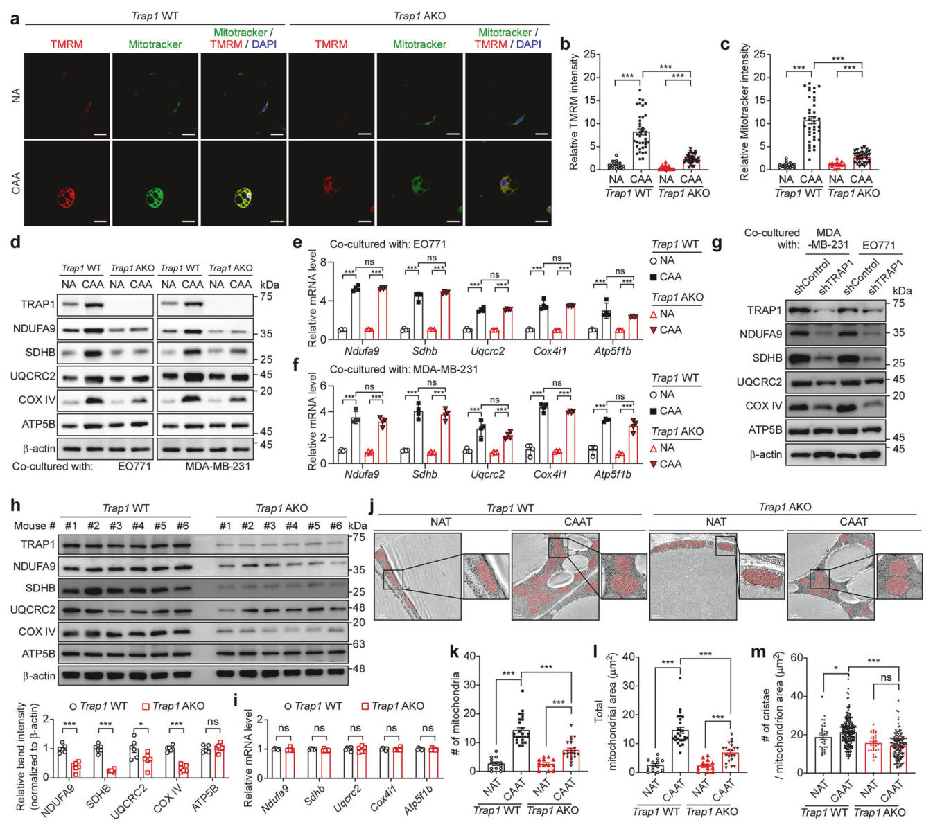 Fig. 3：TRAP1 维持 CAA 的线粒体功能——ETC 亚基蛋白（mRNA 不变）与电镜下线粒体数量/嵴密度在 AKO 中全部逆转