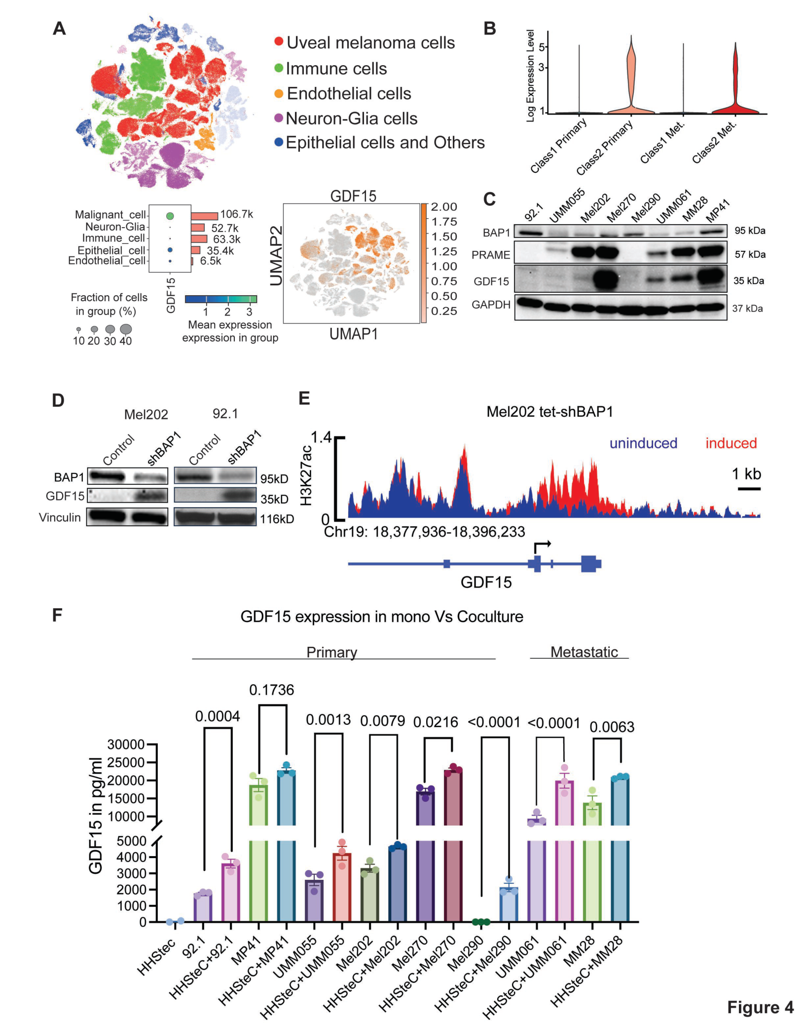 Fig. 4:GDF15 expression is upregulated in some BAP-1 negative expressing UM cells.