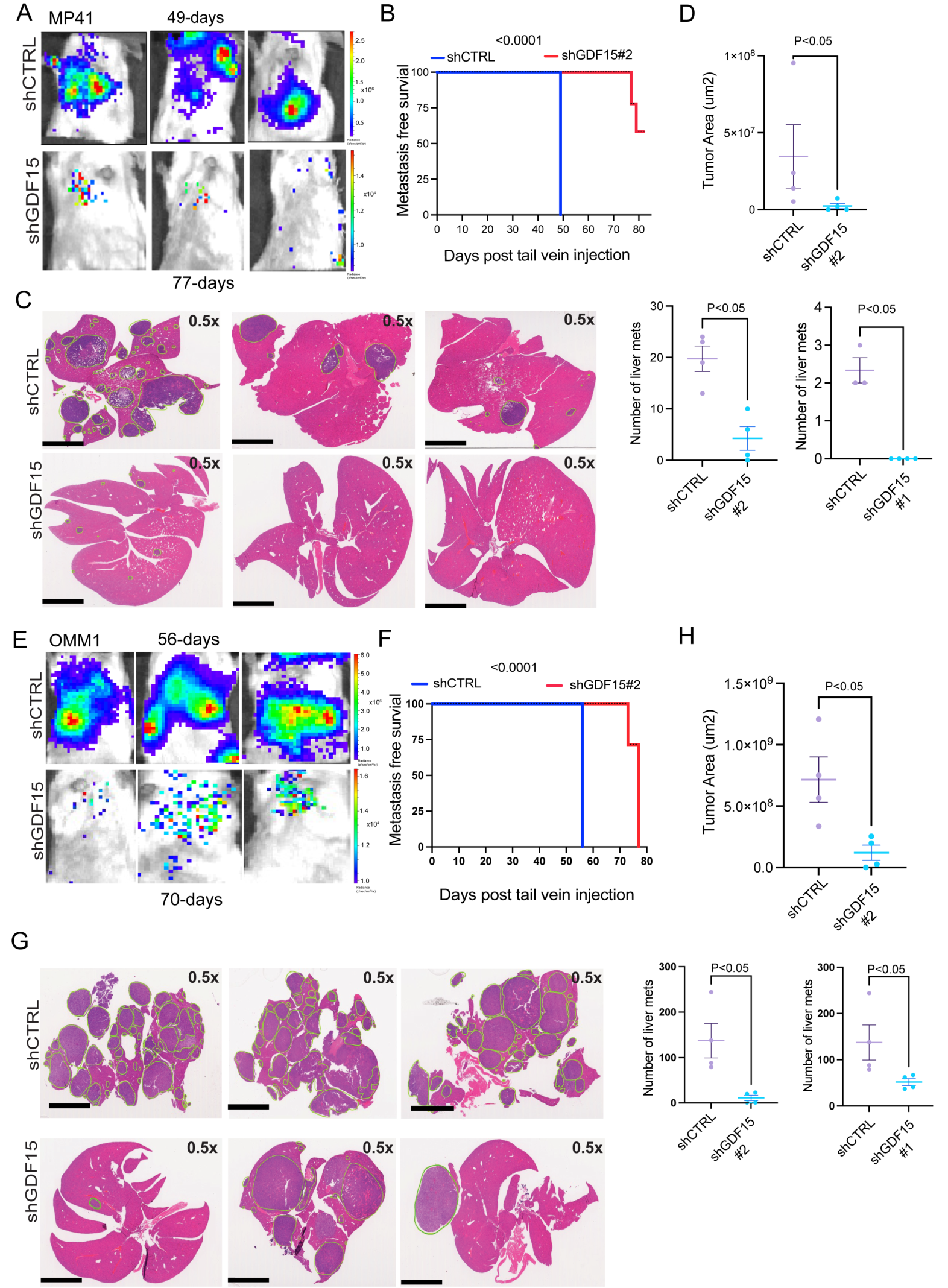 Fig. 7:Silencing of GDF15 reduces the formation of MP41 and OMM1 UM liver