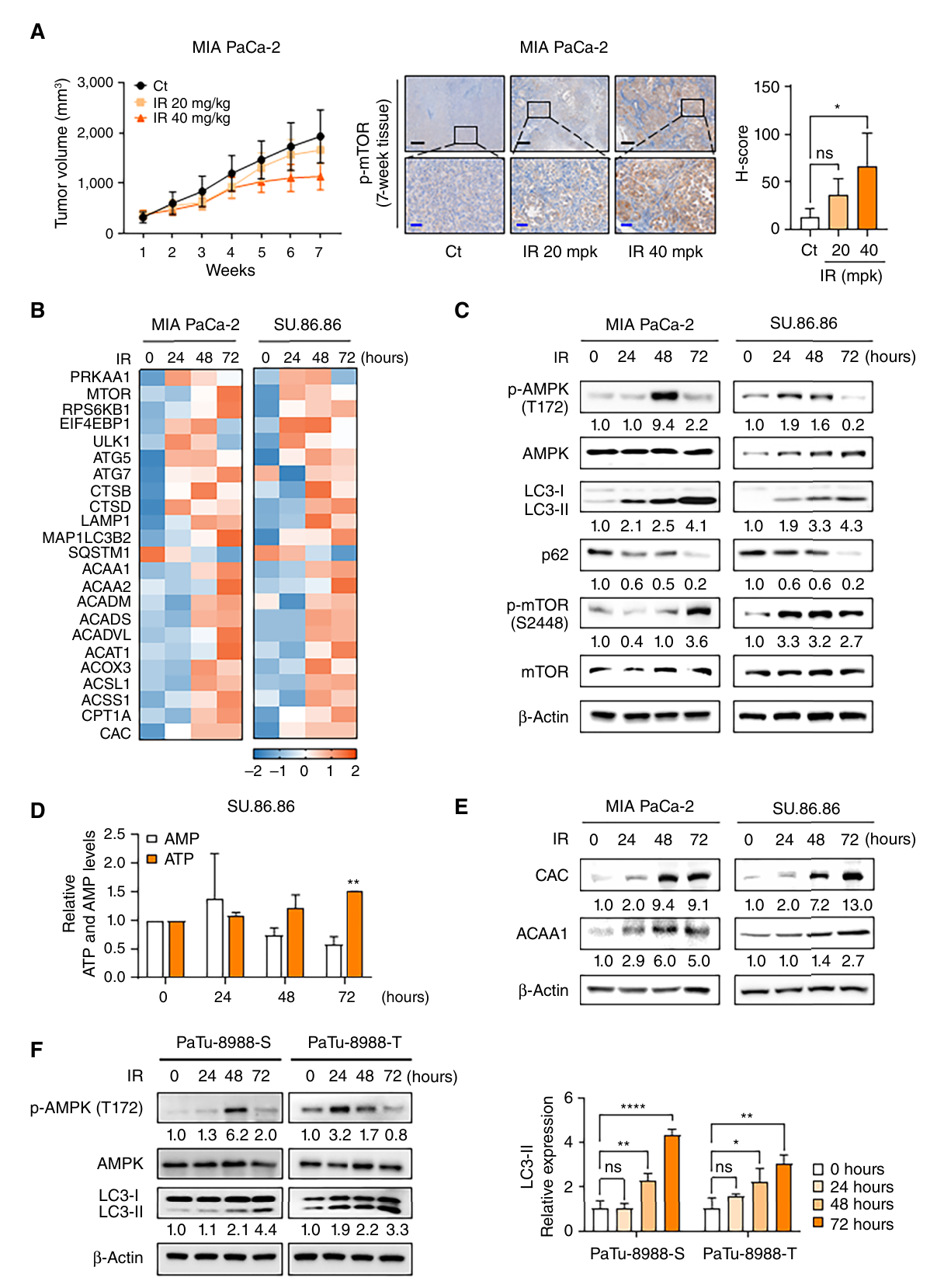 Fig. 1:IR treatment simultaneously increased autophagy and FAO. A, MIA PaCa-2 cell–derived xenograft tumors were established, and mice were randomized into Ct (white, n ¼ 5), IR 20 mg/kg (light orange, n ¼ 5), and IR 40 mg/kg (orange, n ¼ 5) groups when tumor volumes reached ∼300 mm3. Tumor growth curves are