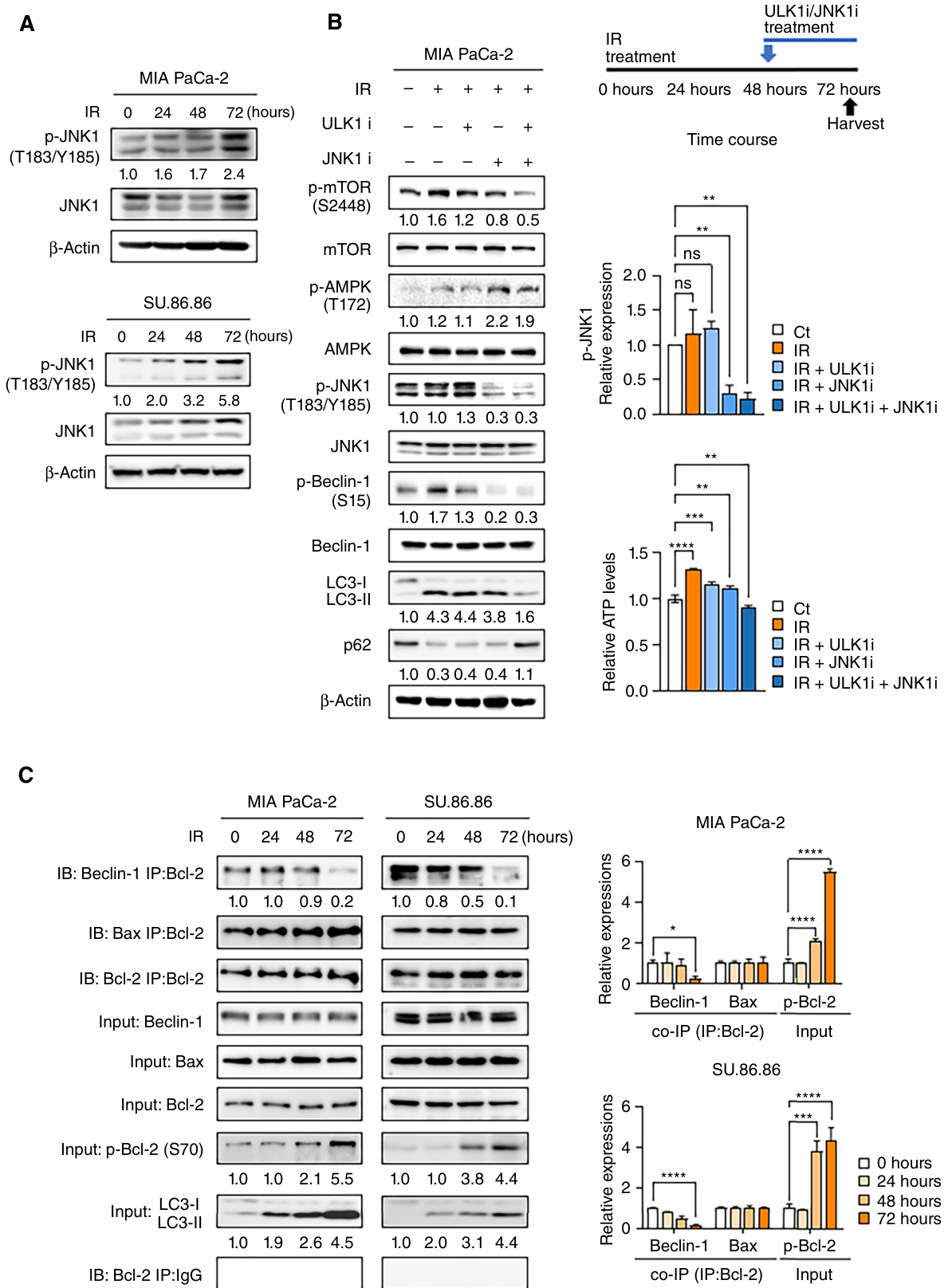 Fig. 2:Autophagy depends on JNK1-induced Beclin-1 activation. A, Pancreatic cancer cell lines MIA PaCa-2 and SU.86.86 were treated with IR (1 μmol/L) for immunoblotting. B, Immunoblot analysis of late-stage autophagy in MIA PaCa-2. ULK1 inhibitor (ULK1i, XST-14, 5 μmol/L; ref. 28) and JNK1 inhibitor (JNK1i,