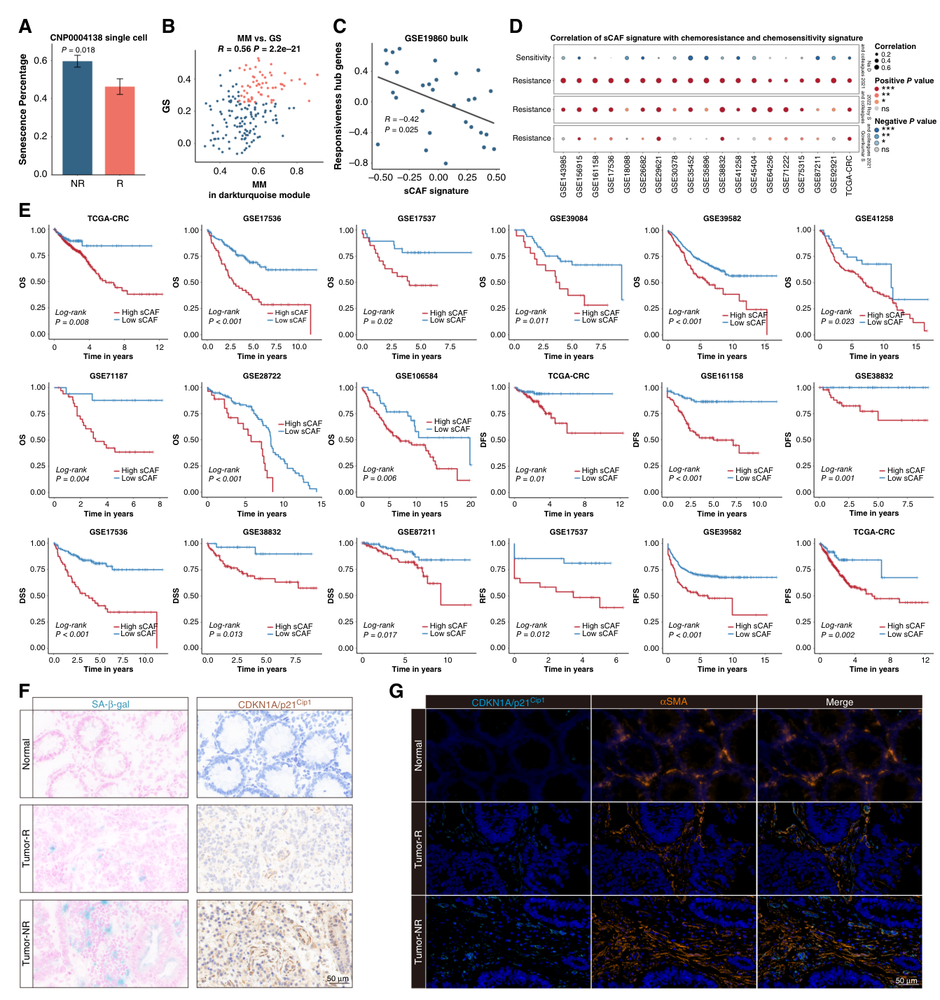 Fig. 2：sCAFs contribute to chemotherapy resistance and poor prognosis in colorectal cancer. A, Senescence percentage of CAFs across chemotherapy responsive (R) and nonresponsive (NR) samples in the discovery cohort. Data are mean ± SD. B, Scatterplot displaying the Pearson correlation between module membership (MM) and gene significance (GS) of genes in the darkturquoise module. Hub genes, highlighted in red, were selected based on the thresholds: MM > 0.5 and GS > 0.25. C, Correlation analysis showing a negative association between sCAF signature scores and hub gene scores calculated by GSVA in GSE19860. D, Dot plot showing the Pearson correlations of the sCAF signature with chemoresistance and chemosensitivity signatures. Dot color respectively represents positive correlation (red), negative correlation (blue), or no significant correlation (grey), whereas dot size reflects the absolute value of the correlation coefficient. E, Kaplan–Meier survival curves showing the association of higher sCAF abundance (calculated by CPM deconvolution) with poorer overall survival (OS), progression-free survival, disease-free survival (DFS), relapse-free survival (RFS), and disease-specific survival (DSS). F, Representative images of SA-β-gal staining (left) and IHC for p21 (right) on responsive (R; n ¼ 3) and nonresponsive (NR; n ¼ 3) colorectal cancer samples, as well as on normal tissue samples (n ¼ 3). G, mIHC for p21 and αSMA was performed on R (n ¼ 3) and NR (n ¼ 3) colorectal cancer samples and normal tissue samples (n ¼ 3). A. Statistical analysis was performed using two-tailed Wilcoxon rank-sum test; E, Statistical analysis was performed using the log-rank test. ns, not significant; , P < 0.05; , P < 0.01; , P < 0.001.