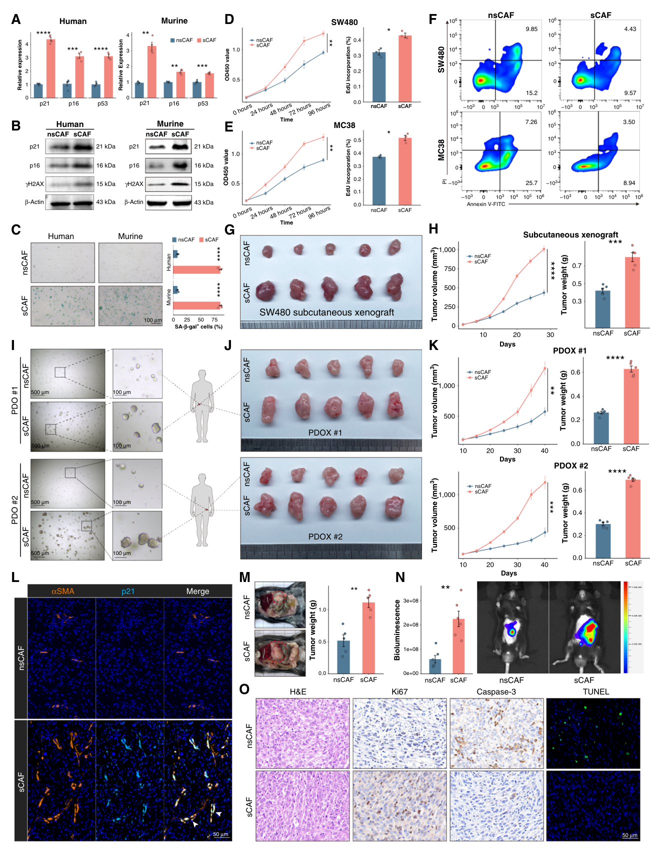 Fig. 3：In vitro and in vivo experiments demonstrate the chemoresistance-promoting role of sCAFs. A and B, qPCR (n ¼ 4 per group) and Western blot analyses of mRNA and protein levels for senescence markers in human and murine sCAFs and nsCAFs. C, Representative photographs of SA-β-gal staining and quanti- fication of SA-β-gal+ cells in human and murine sCAFs (n ¼ 3) and nsCAFs (n ¼ 3). D and E, CCK8 and EdU assays showing that CM from sCAFs significantly enhanced colorectal cancer cell proliferation (SW480, MC38) under FOLFOX treatment (n ¼ 3 per group). F, Flow cytometry analysis showing reduced apoptosis in colorectal cancer cells (SW480, MC38) treated with sCAF CM under FOLFOX treatment (n ¼ 3 per group). G, Representative images of subcutaneous xenografts from SW480 colorectal cancer cells coinjected with sCAFs (n ¼ 5) or nsCAFs (n ¼ 5) under FOLFOX treatment. H, Tumor growth curves and final tumor weights of subcutaneous xenografts. I, Organoid formation from PDOs cocultured with sCAFs (n ¼ 3) or nsCAFs (n ¼ 3) under FOLFOX treatment. J, Representative images of PDOXs cocultured with sCAFs (n ¼ 5) or nsCAFs (n ¼ 5) under FOLFOX treatment. K, Tumor volume growth curves and final weights from PDOX models. n ¼ 5 per group. L, mIHC for p21 and αSMA in orthotopic tumors, with tumor cells mixed with sCAFs or nsCAFs before injection. n ¼ 3 per group. M, Representative images and quantification of tumor weights from orthotopic tumor models under FOLFOX treatment. n ¼ 5 per group. N, Representative bioluminescence images and quantification of bioluminescence intensity for orthotopic tumor models under FOLFOX treatment. n ¼ 6 per group. O, H&E staining and IHC for orthotopic tumors under FOLFOX treatment. n ¼ 3 per group. Data are mean ± SD. Statistical analysis was performed using the two-tailed unpaired t test. ns, not significant; , P < 0.05; , P < 0.01; , P < 0.001; , P < 0.0001.