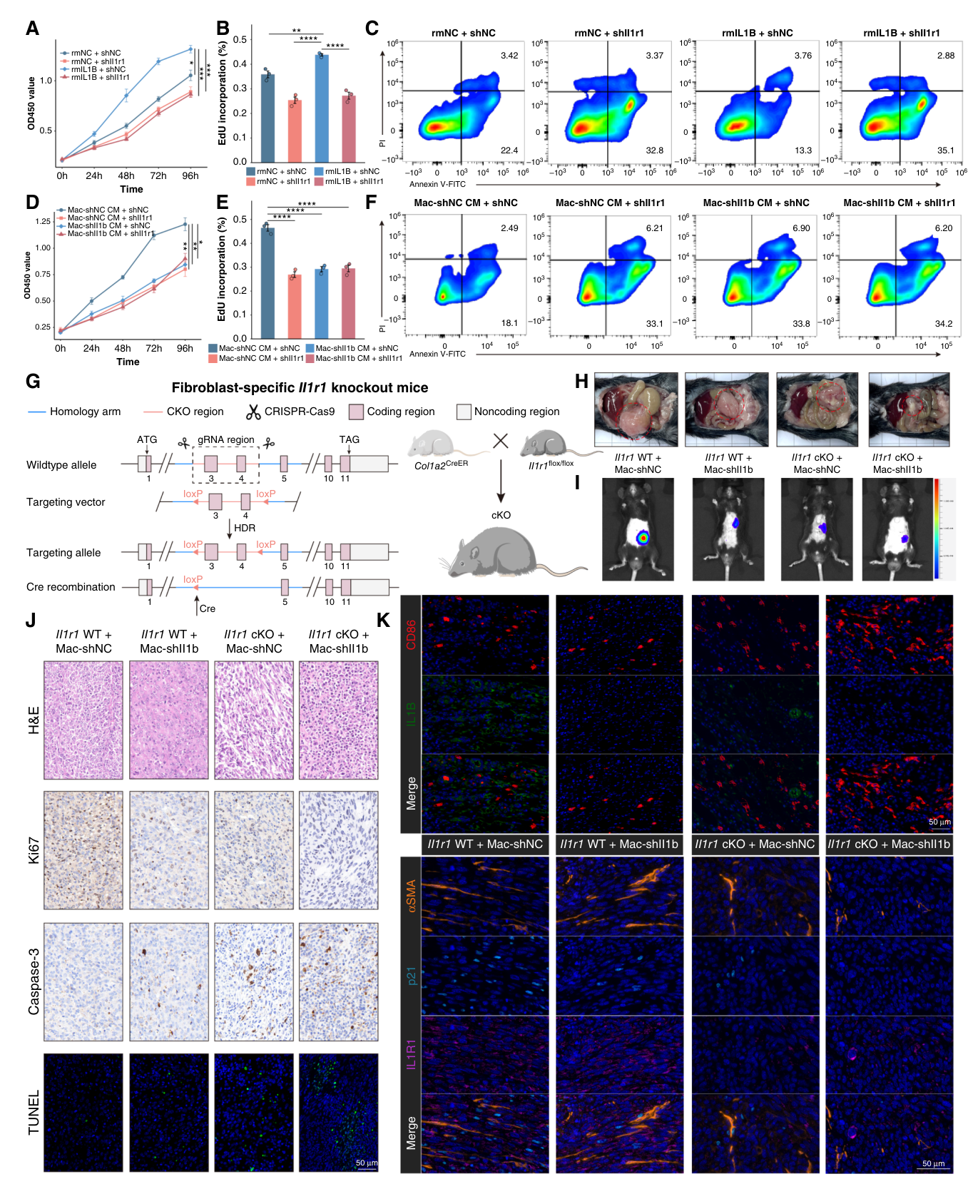 Fig. 7：IL1B–IL1R1 interaction between macrophages and CAFs leads to chemotherapy resistance in colorectal cancer. A–C, CCK8, EdU, and flow cytometry analyses of colorectal cancer cells (MC38) under FOLFOX treatment, treated with CM from control or IL1R1-knockdown CAFs, which were pretreated with or without rmIL1B