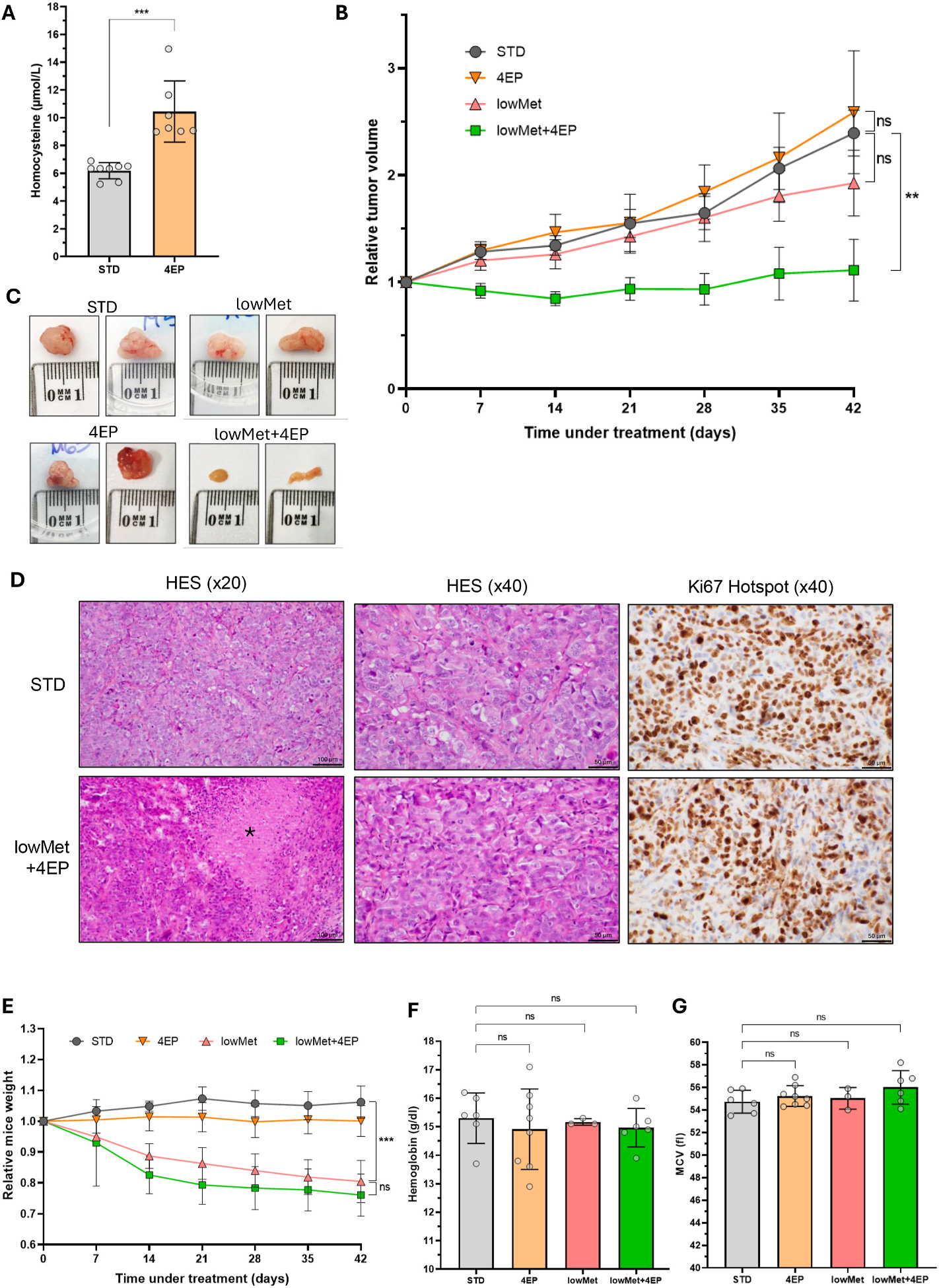 Fig. 5：Synergistic antitumor effect and good tolerability of combined methionine restricted diet and vitamin B12 antagonist in vivo A. Plasma homocysteine levels after 6 weeks of treatment with the vitamin B12 antagonist 4-ethylphenylcobalamin (4 EP, 167.04 nmol/day via subcutaneous osmotic minipumps), compared to vehicle-treated controls under standard diet (STD). B. Tumor growth kinetics (relative tumor volume) under four treatment groups: STD, 4 EP, lowMet (low methionine diet), and lowMet+4 EP. Statistical comparisons referred to comparison of relative tumor volume at day 42 compared to mice of the STD group. C. Representative images of xenografts collected at endpoint, selected near the median tumor weight for each group. D. Histological and immunohistochemical analysis of tumors from the STD and lowMet+4 EP groups. Hematoxylin–eosin–saffron (HES) staining at ×20 (left) and ×40 (middle), and Ki67 immunostaining (right) showing hotspot Ki67 labeling. Asterisks indicate necrotic areas. E. Body weight evolution relative to baseline over time in the four treatment groups. F-G. Hemoglobin levels (F) and mean corpuscular volume (MCV) (G) after 42 days of treatment. Data are presented with mean ± SD. Statistical significance determined by Student&rsquo;s t-test. p < 0.05; p < 0.01; p < 0.001; ns: not significant.