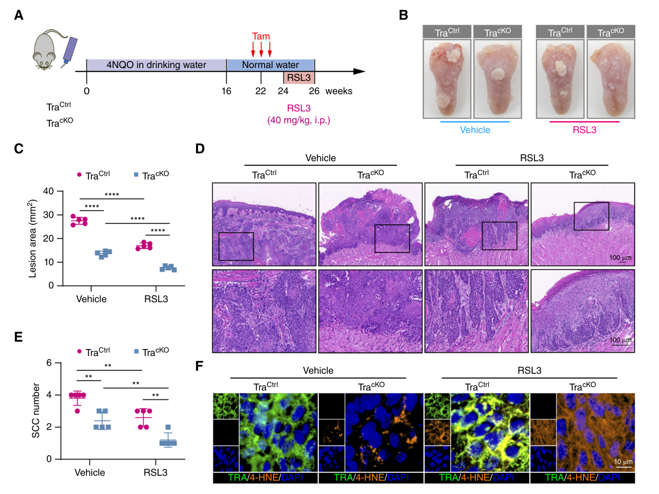 Fig. 3：Trappc4 deficiency promotes the sensitivity of 4NQO-induced autochthonous HNSCC to RSL3 in mice. A, Diagram of the induction process of TraCtrl and TracKO