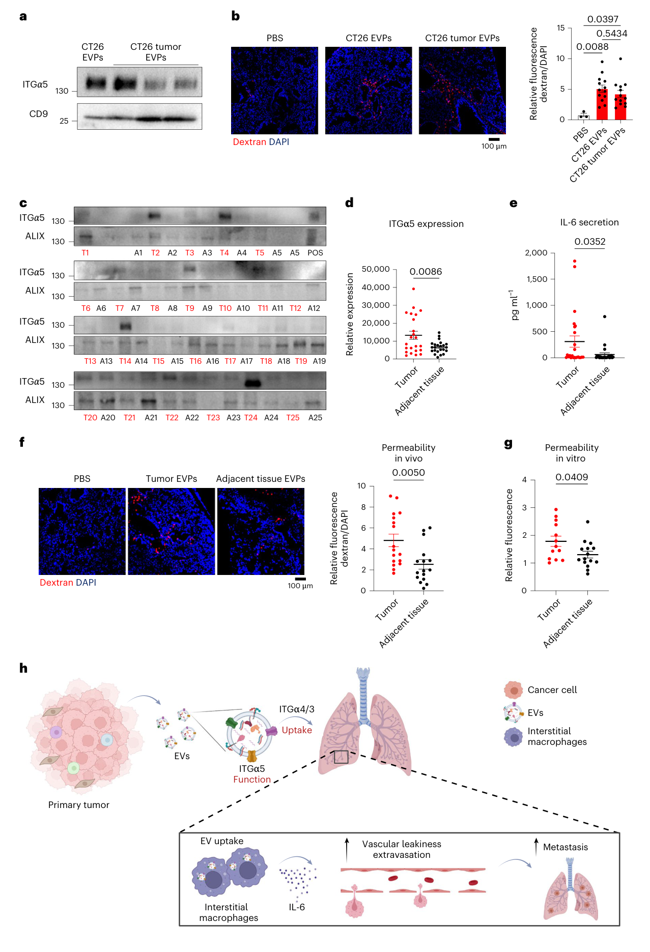 Fig. 7：Tumor-derived EVPs from colorectal cancer promote elevated ITGα5, IL-6 secretion and vascular permeability. a, Western blot analysis of ITGα5 expression in EVPs derived from CT26 colon cancer cells and tumor tissue explants. CD9 was used as a loading control. Data were derived from one independent experiment. b, Representative images (left) and associated statistical analysis (right) of in vivo vascular permeability. DAPI-stained nuclei appear in blue. Data represent the mean ± s.e.m., analyzed using an unpaired t-test with Welch’s correction. Data include 13 images per group, from n = 3 mice for each group, from one independent experiment. PBS was used as a control. c, Western blot analysis of ITGα5 in EVPs from 24 colon cancer tumors (black) and adjacent tissues (red). Alix was used as a loading control. Data were derived from one independent experiment. d, Relative expression of ITGα5 from the western blot analysis in Fig. 7c. Data represent the mean ± s.e.m., analyzed using an unpaired t-test with Welch’s correction. Data were derived from n = 25 samples in each group, from one independent experiment. e, IL-6 concentration in human macrophage medium following treatment with EVPs from colon cancer samples (tumor and adjacent tissue). Data represent the mean ± s.e.m., analyzed using an unpaired t-test with Welch’s correction. Data were derived from n = 25 samples