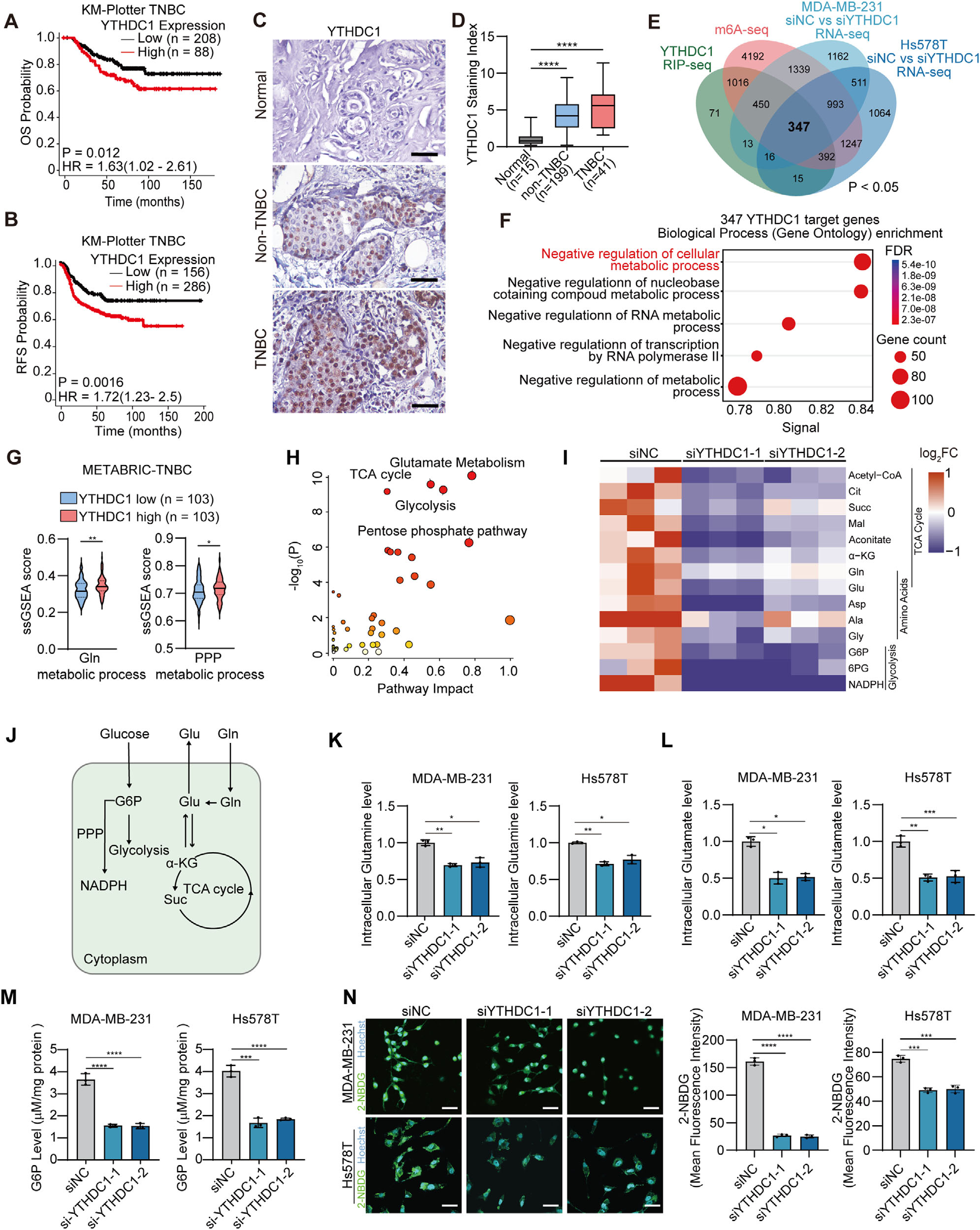 Fig. 1：YTHDC1 rewires glucose and glutamine metabolism in TNBC. (A,B) Survival analysis of TNBC patients from Kaplan–Meier plotter database reveals that high expression of YTHDC1 is significantly associated with poorer overall survival (OS) (A) and progression-free survival (PFS) (B). (C,D) Immunohistochemistry of YTHDC1 in tissue microarray (TMA) reveals that expression of YTHDC1 in TNBC is significantly higher than in non-TNBC and normal tissue. Scale bars, 20 µm. (E) Venn diagram analysis integrating RNA-seq (MDA-MB-231and Hs578T), m6A-seq (MDA-MB-231), and YTHDC1 RIP-seq (MDA-MB-231) data identifies 347 protein-coding genes as high-confidence m6A-dependent targets of YTHDC1. Hypergeometric testing confirms that the three-way intersection is highly significant ( p < 0.05). (F) Gene Ontology (GO) analysis of the 347 candidate genes from (D) reveals significant enrichment in cellular metabolic process. (G) TNBC samples with high YTHDC1 expression exhibit higher ssGSEA scores of glutamine (Gln) metabolism and pentose phosphate pathways (PPP) signature compared to those with low YTHDC1 expression in METABRIC-TNBC