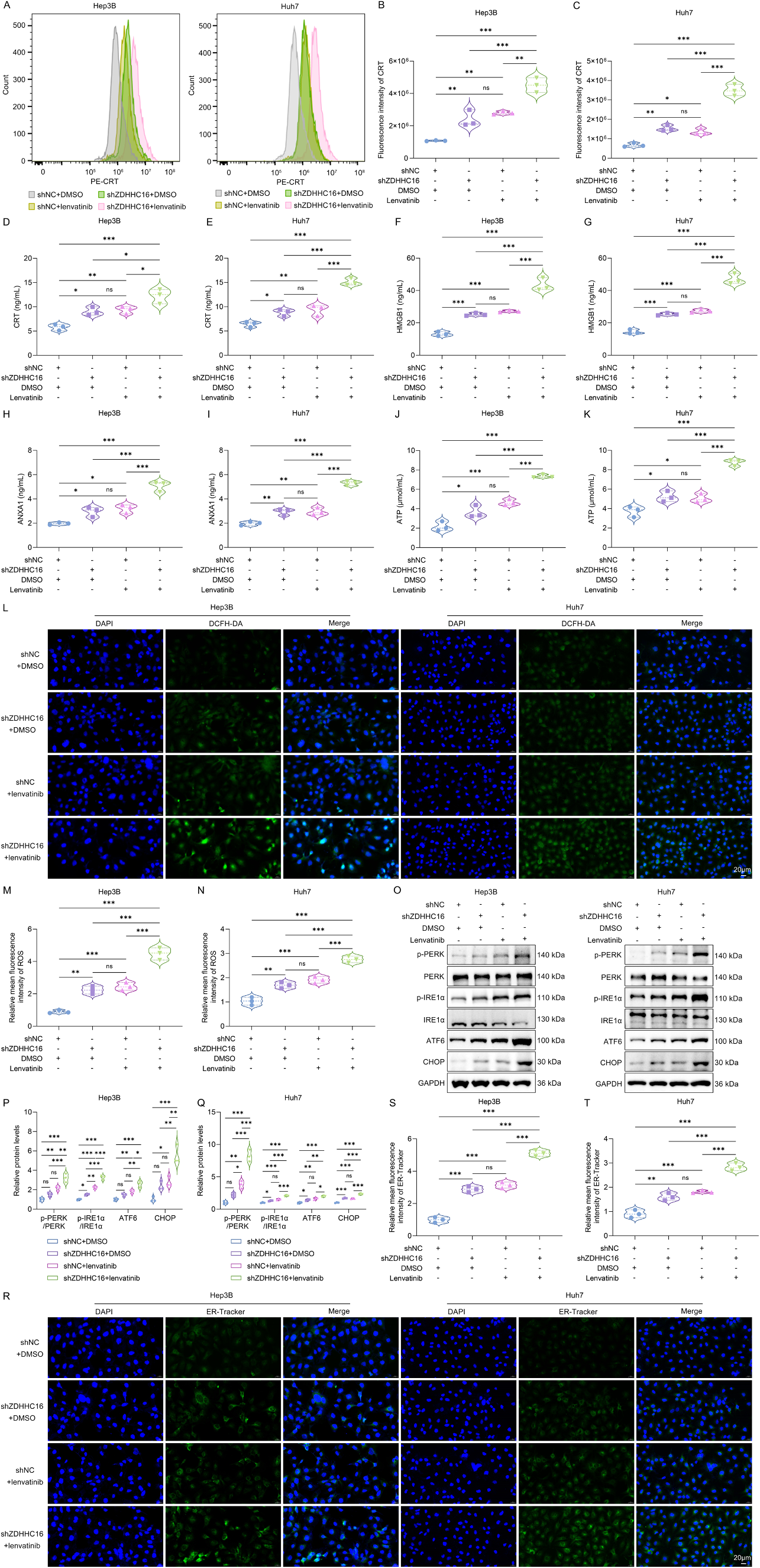 Fig. 2：Knockdown of ZDHHC16 improves lenvatinib-induced ICD in HCC cells. (A) Representative histogram illustrating the percentage of CRT-expressing Hep3B and Huh7 cells as measured by flow cytometry. Cells were transfected with shZDHHC16 or shNC for 48 h and treated with 10 μM lenvatinib or DMSO for 24 h. (B, C) Mean fluorescence intensity value for CRT staining. (D-K) ELISA assays for measuring the extracellular levels of (D, E) CRT, (F, G) HMGB1, (H, I) ANXA1, and (J, K) ATP in the supernatant of HCC cells that were transfected with shZDHHC16 or shNC for 48 h and treated with 10 μM lenvatinib or DMSO for 24 h. (L-N) DCFH-DA probe staining for detecting the intracellular ROS levels in HCC cells with transfection of shZDHHC16 or shNC for 48 h and treatment with 10 μM lenvatinib or DMSO for 24 h. Scale bar, 20 μm. (O-Q) Western blot for measuring the expression levels of phosphorylated PERK and IRE1α, as well as ATF6 and CHOP in HCC cells, after transfecting with shZDHHC16 or shNC for 48 h and treating with 10 μM lenvatinib or DMSO for 24 h. (R-T) ER-Tracker Green fluorescent probe staining for evaluation of ER stress in HCC cells with transfection of shZDHHC16 or shNC for 48 h and treatment with 10 μM lenvatinib or DMSO for 24 h. Scale bar, 20 μm. , P < 0.05; , P < 0.01; , P < 0.001; ns, P > 0.05 from one-way ANOVA followed by Tukey’s post hoc test.