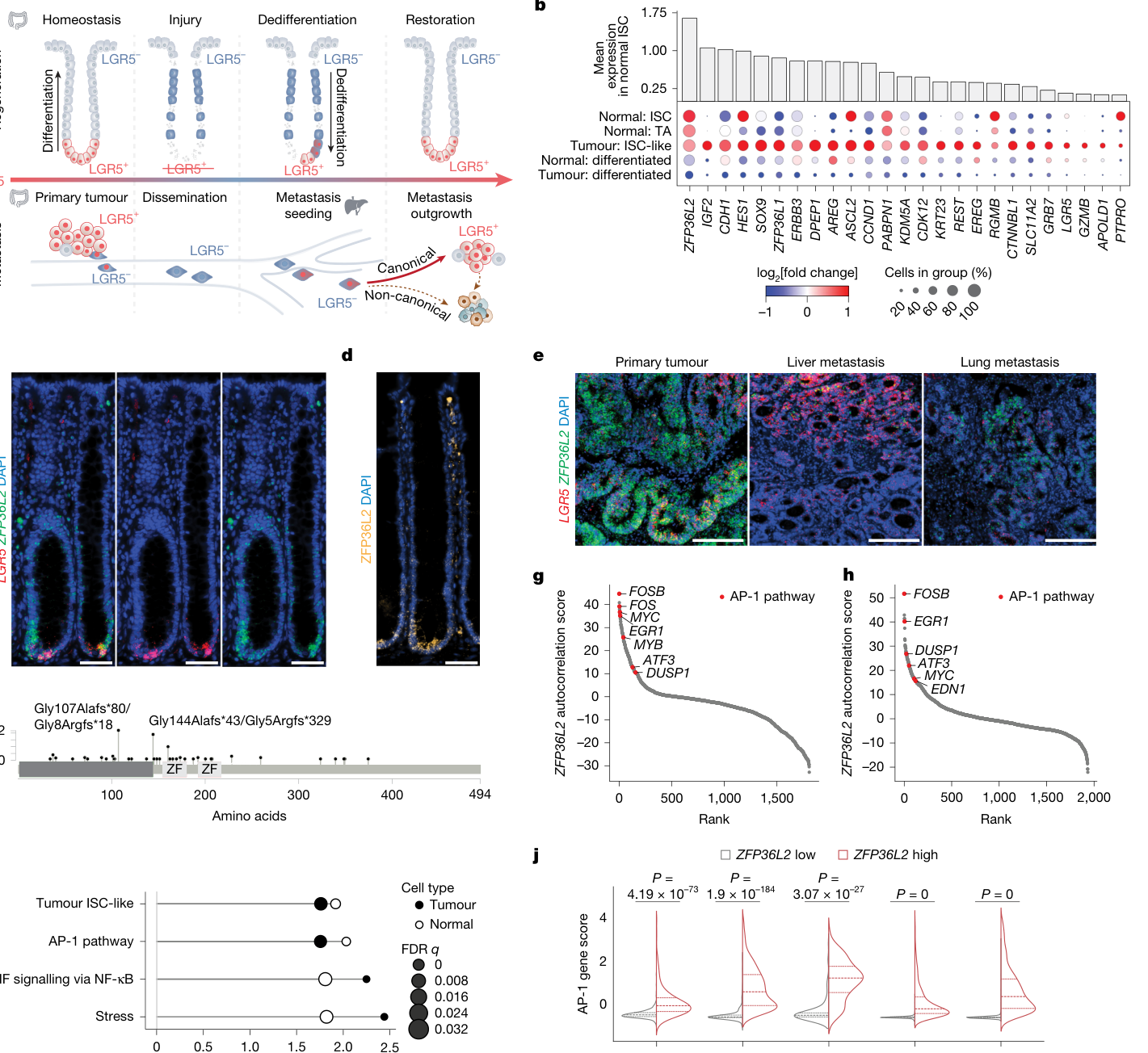 Fig. 1：ZFP36L2 is expressed by ISCs and is associated with the AP-1 gene program. a, Schematic of cell-state plasticity and dynamics during intestinal regeneration (top) and CRC (bottom). b, Dot plot of tumour ISC-like module10 gene expression in normal colon (Normal) and CRC (Tumour) epithelial cells from 25 patients. The dot size indicates the per cent cells (rows) expressing each gene (columns). Colour scale indicates the log2 fold change in average gene expression. Bar plots show the mean expression of each gene across normal colon ISCs. Genes meeting false discovery rate (FDR) < 0.05 using the Wilcoxon rank-sum test (ISC versus all other epithelial subtypes) are shown. c,d, Representative LGR5 and ZFP36L2 RNA FISH (c) and ZFP36L2 IF (d) images of human normal colon crypts. e, Representative LGR5 and ZFP36L2 RNA FISH images of human primary CRC tumours (n = 2), liver metastases (n = 2) and lung metastases (n = 2) from 2 donors. f, Lollipop plot showing ZFP36L2 mutation